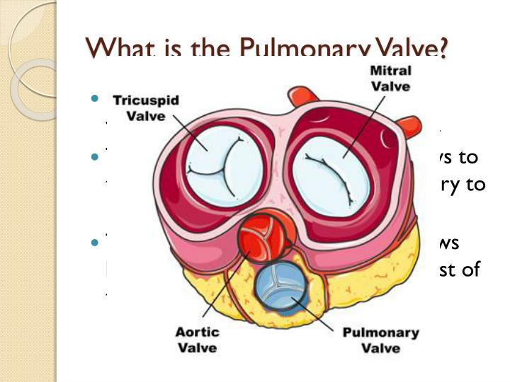 PPT - Pulmonary Valve Stenosis PowerPoint Presentation - ID:2522698