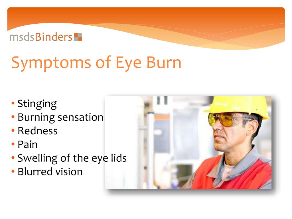 PPT Eye Health & Safety Chemical Exposure in the Workplace