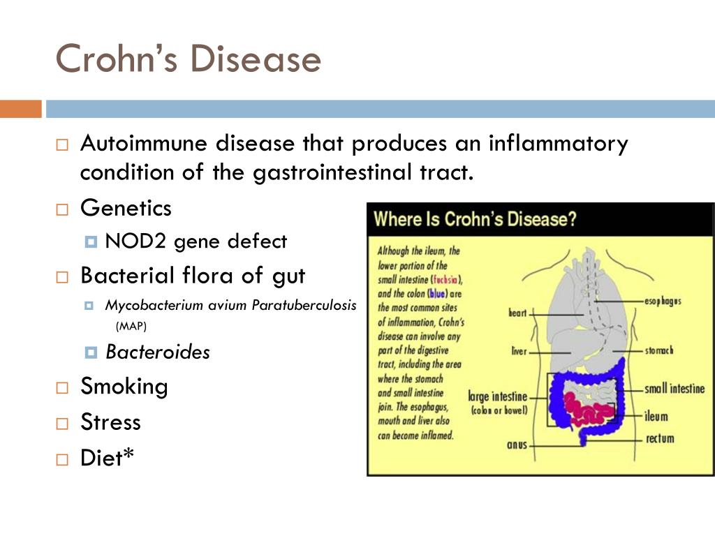 PPT An Investigation on the Evolution of Autoimmune Disease