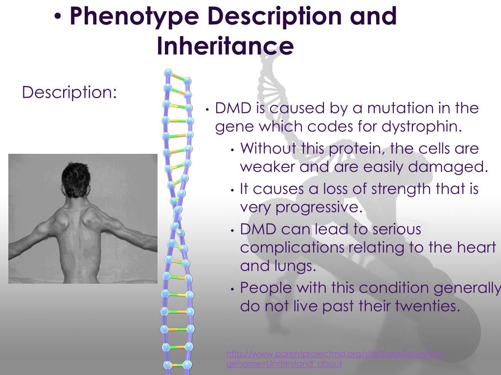 Muscular Dystrophy muscular-dystrophy