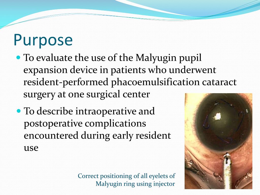 Cataract Surgery with Zonular Issues