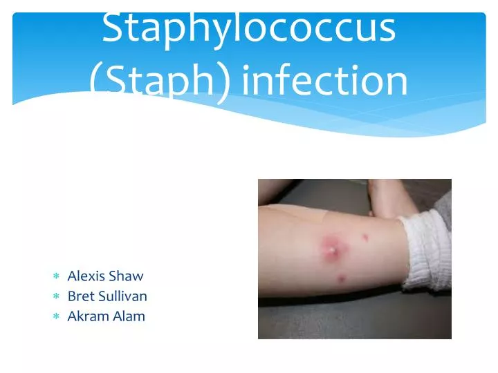 early stage minor staph infection early stage minor staph infection