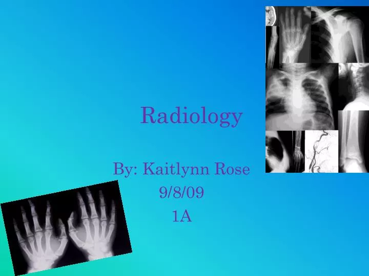 download towers radiology