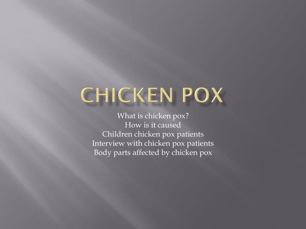 PPT - Chicken pox PowerPoint Presentation, free download - ID:2604004