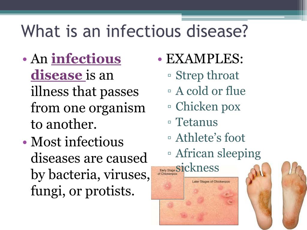 infectious diseases presentation