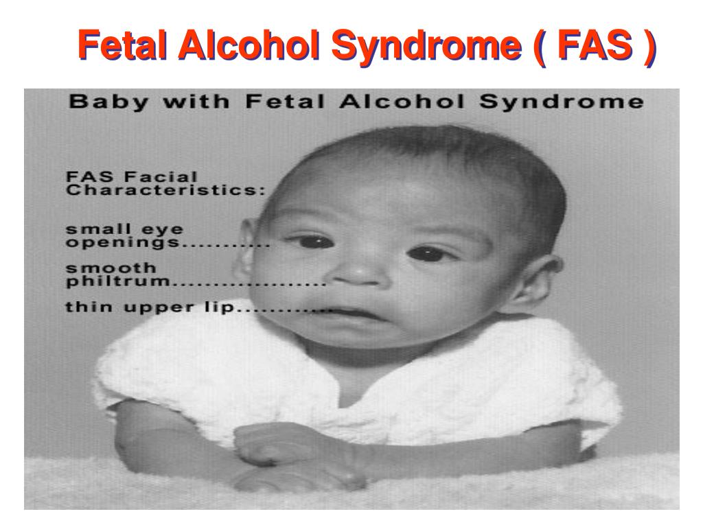 PPT - Teratogens and drugs of abuse in pregnancy PowerPoint ...