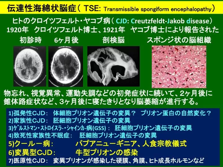 Ppt 伝達性海綿状脳症 Tse Transmissible Spongiform Encephalopathy Powerpoint Presentation Id