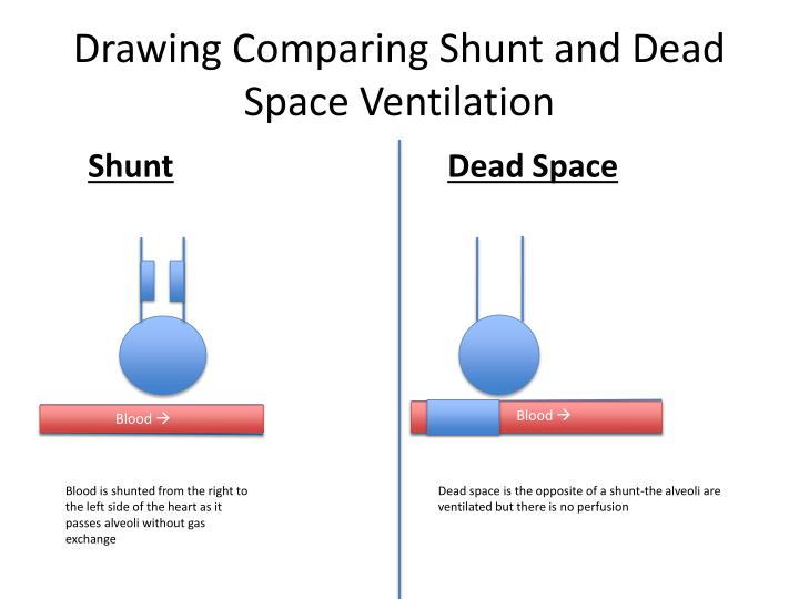 mismatch vs. shunt vs. dead space