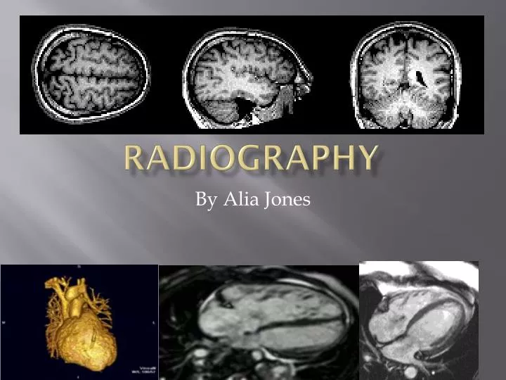 seminar presentation topics in radiography