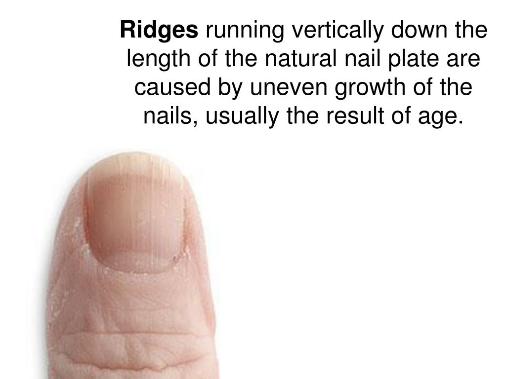 Nail conditions we treat - Hope Dermatology