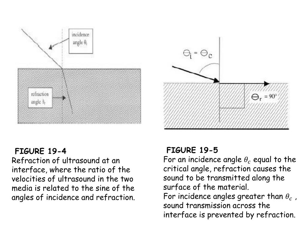 PPT ULTRASOUND In MEDICINE PowerPoint Presentation, free download