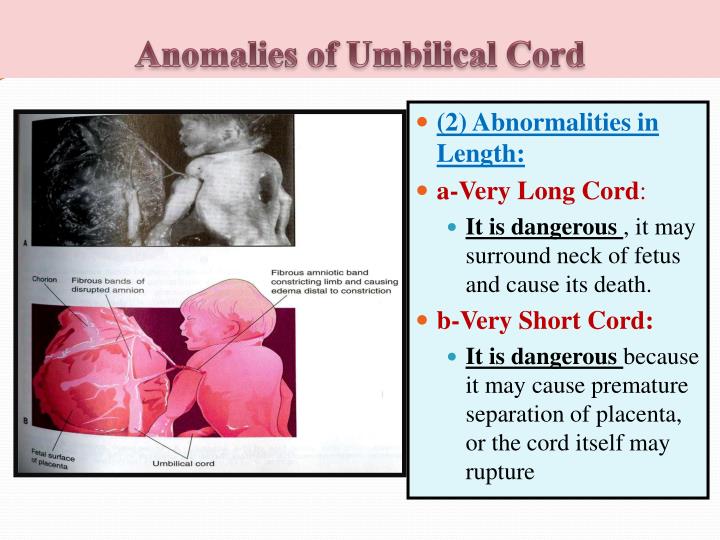 PPT Fetal Membranes PowerPoint Presentation ID2652392