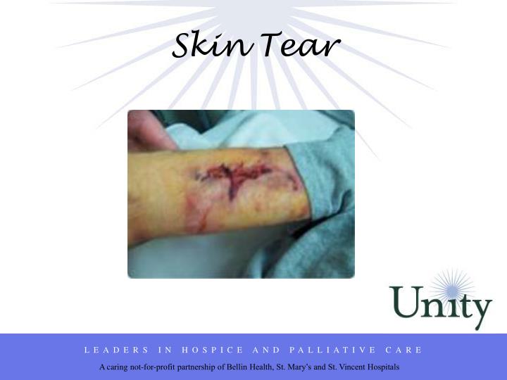 PPT Wound Care for the Hospice and Palliative Patient PowerPoint