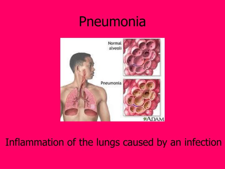 PPT The Effects of Smoking PowerPoint Presentation ID2669859