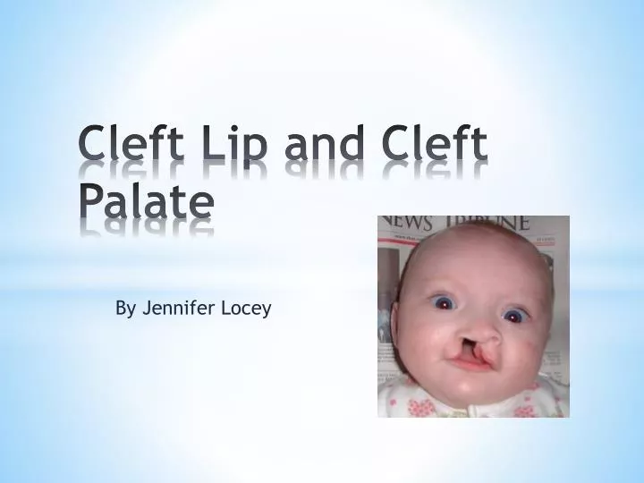 Lips Anatomy Ppt - Infoupdate.org