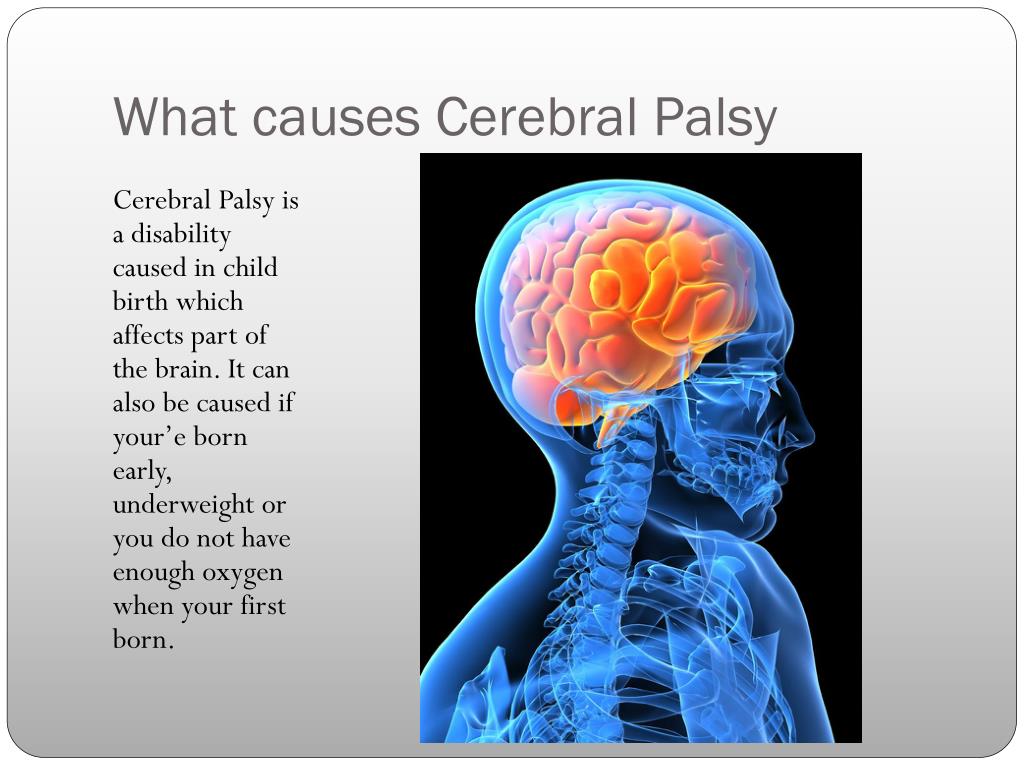 presentation on cerebral palsy