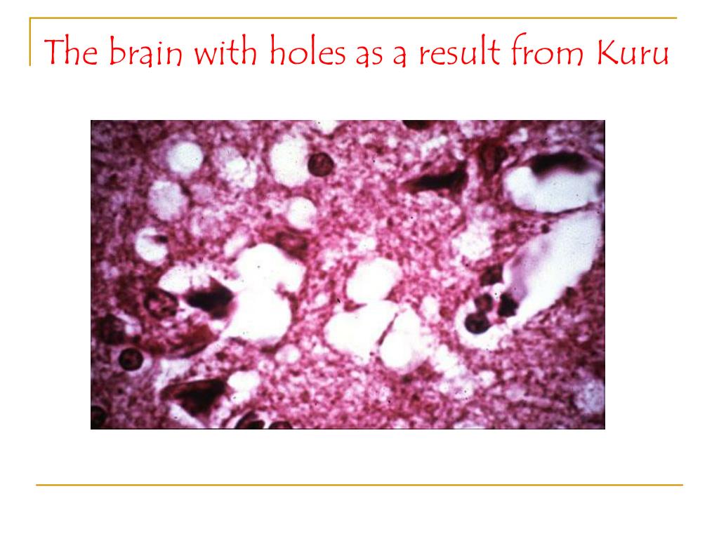 PPT Kuru PowerPoint Presentation, free download ID2682098