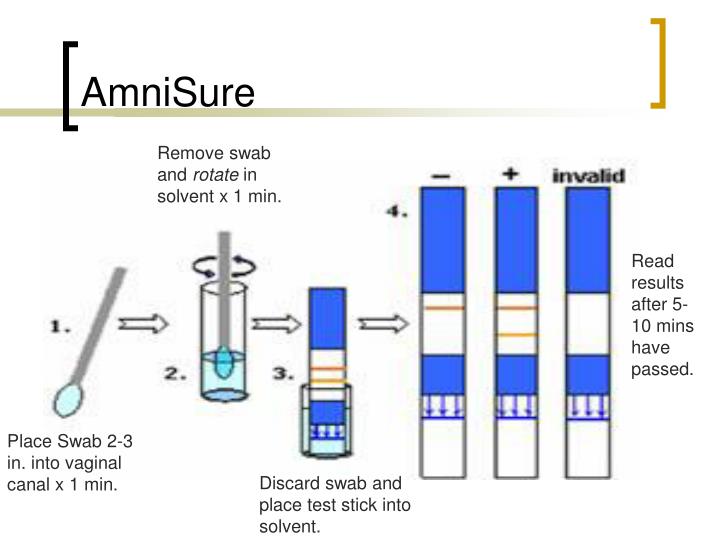 PPT Preterm Rupture of Membranes PowerPoint Presentation ID2686700
