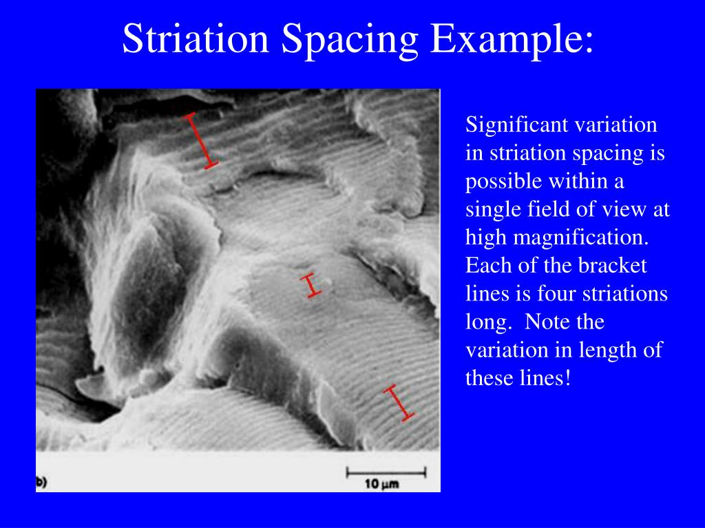 what allows the visual presentation of striations
