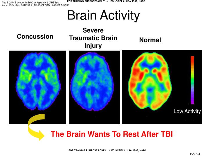 PPT TBI and MACE PowerPoint Presentation ID2699821