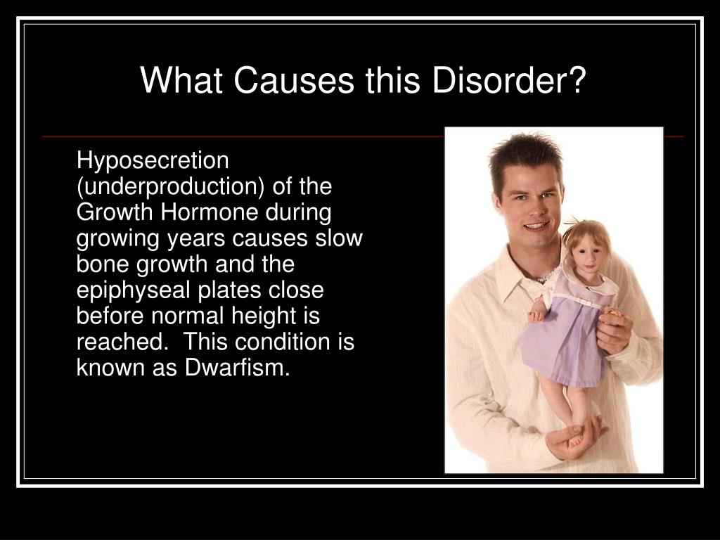 Ppt Pituitary Dwarfism Powerpoint Presentation Free Download Id