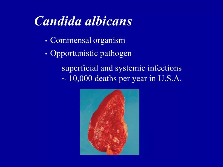 ppt opportunistic pathogen powerpoint presentation id 2715528 opportunistic pathogen