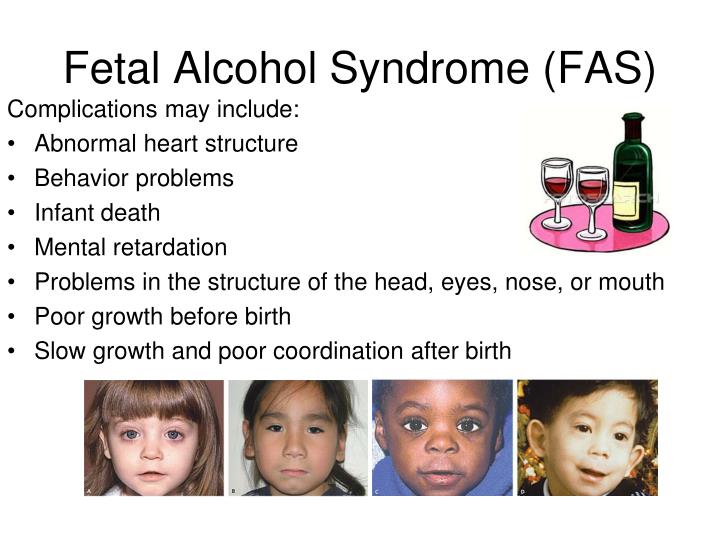 PPT - Neural tube defects (NTD’s) PowerPoint Presentation - ID:2716133