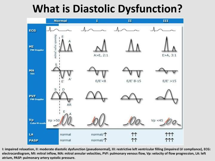 ppt-diastolic-dysfunction-as-diagnosed-and-quantified-by