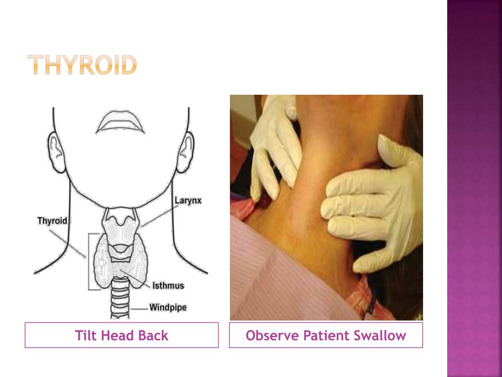 PPT - Head and Neck Review Intra/Extra O ral Examination PowerPoint