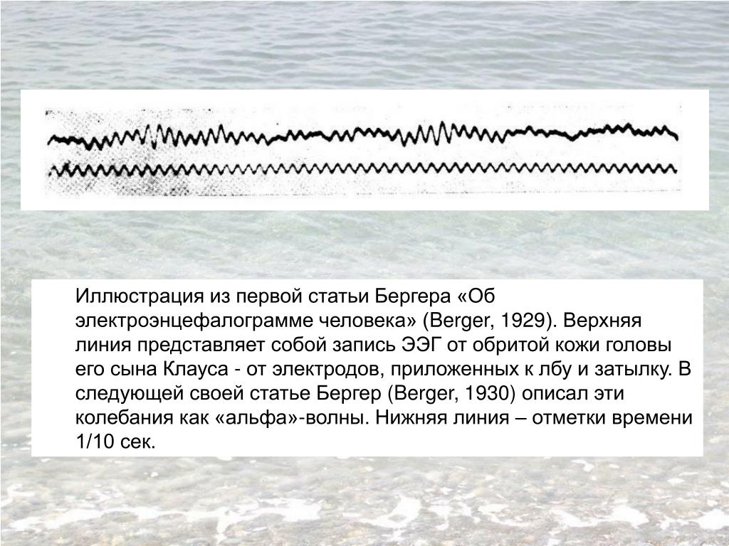 Верхняя линия. Ханс Бергер электроэнцефалограмма. Ганс Бергер 1929. Ганс Бергер открыл электроэнцефалографию человека.. Первый электроэнцефалограф.