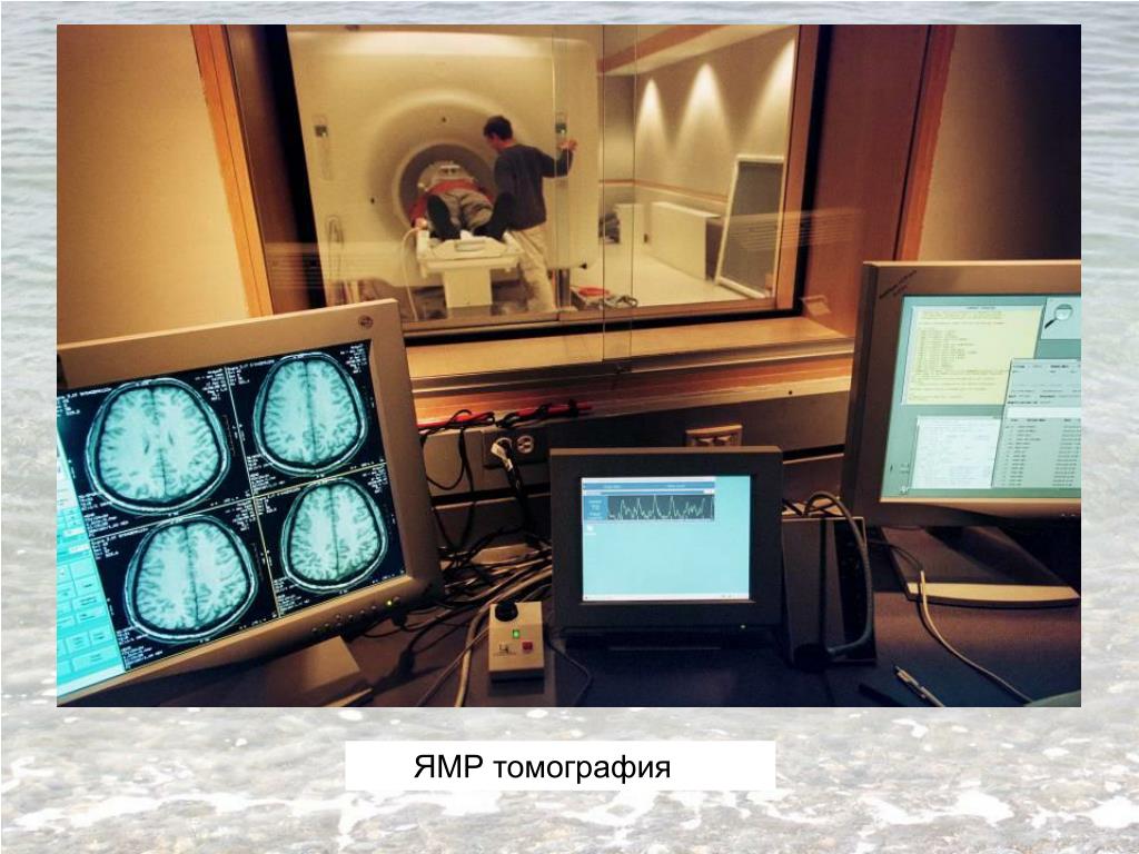 Мониторинг магнитных. Ядерная магнитно резонансная интроскопия. Ядерная магнитная резонансная интроскопия. Ядерно Магнито-резонансная томография. ЯМР интроскопия.