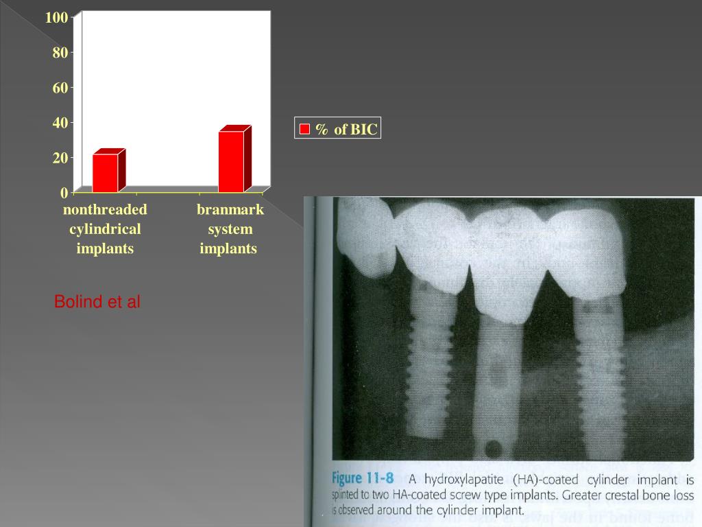 PPT - Scientific rationale for dental implant design PowerPoint ...