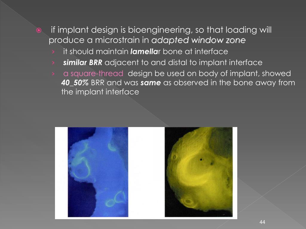 PPT - Scientific rationale for dental implant design PowerPoint ...