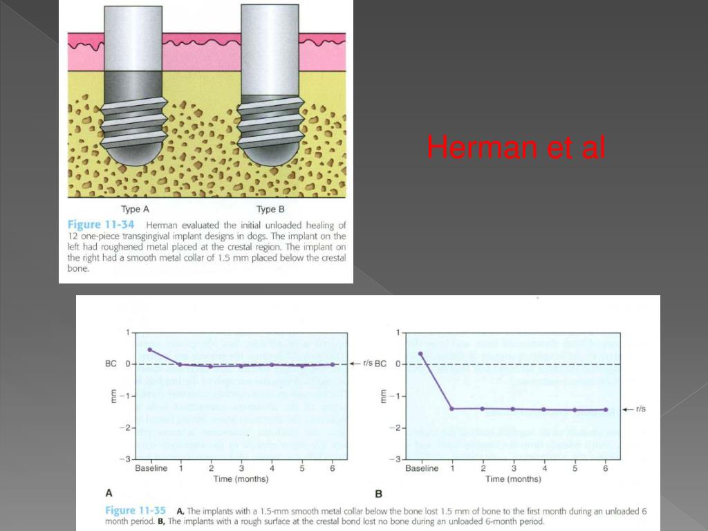 PPT - Scientific rationale for dental implant design PowerPoint ...