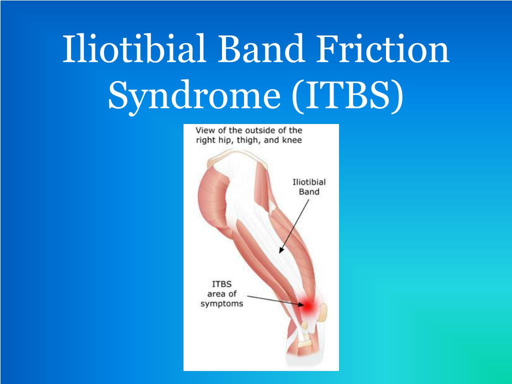 PPT - Iliotibial Band Friction Syndrome (ITBS) PowerPoint