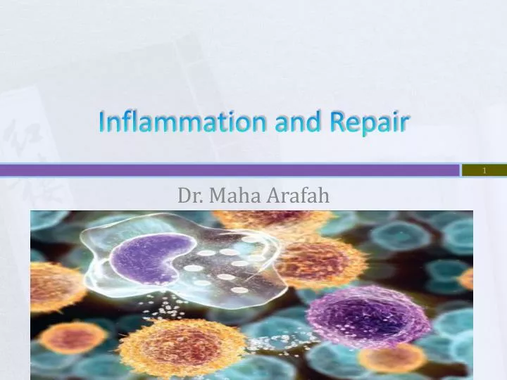 PPT  Inflammation and Repair PowerPoint Presentation, free download