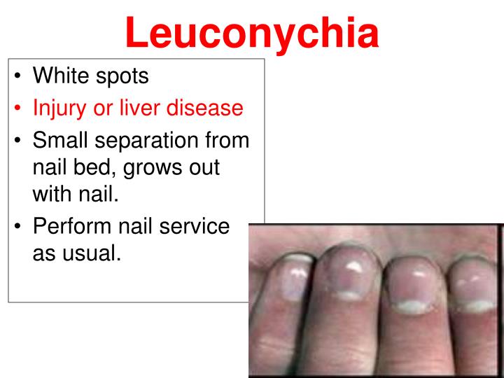 PPT Nail Theory PowerPoint Presentation ID 2742453