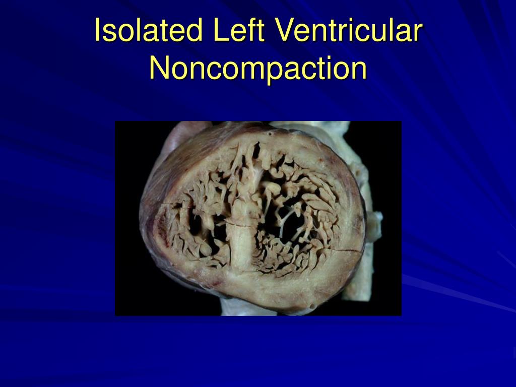 PPT - Clinical Pathology Conference “62 year old woman with weakness ...