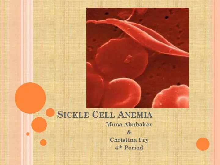 powerpoint presentation on sickle cell anemia