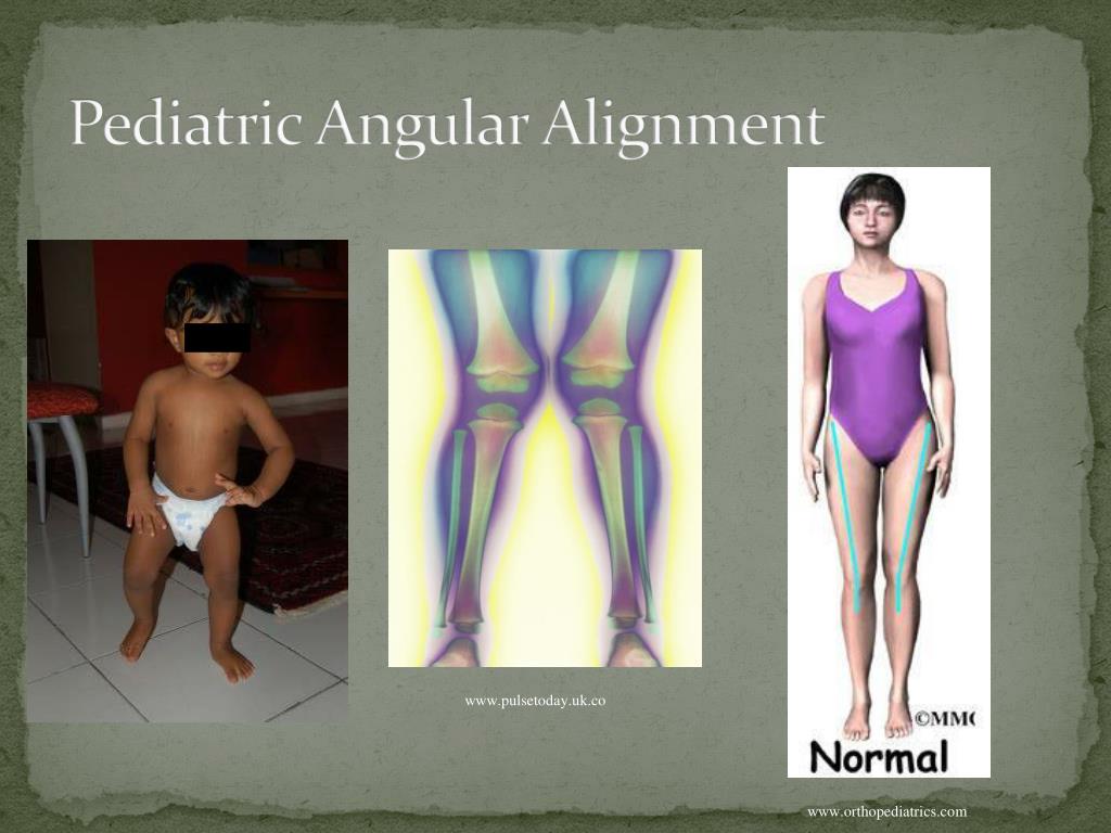 The Human Knee Joint - Part 3