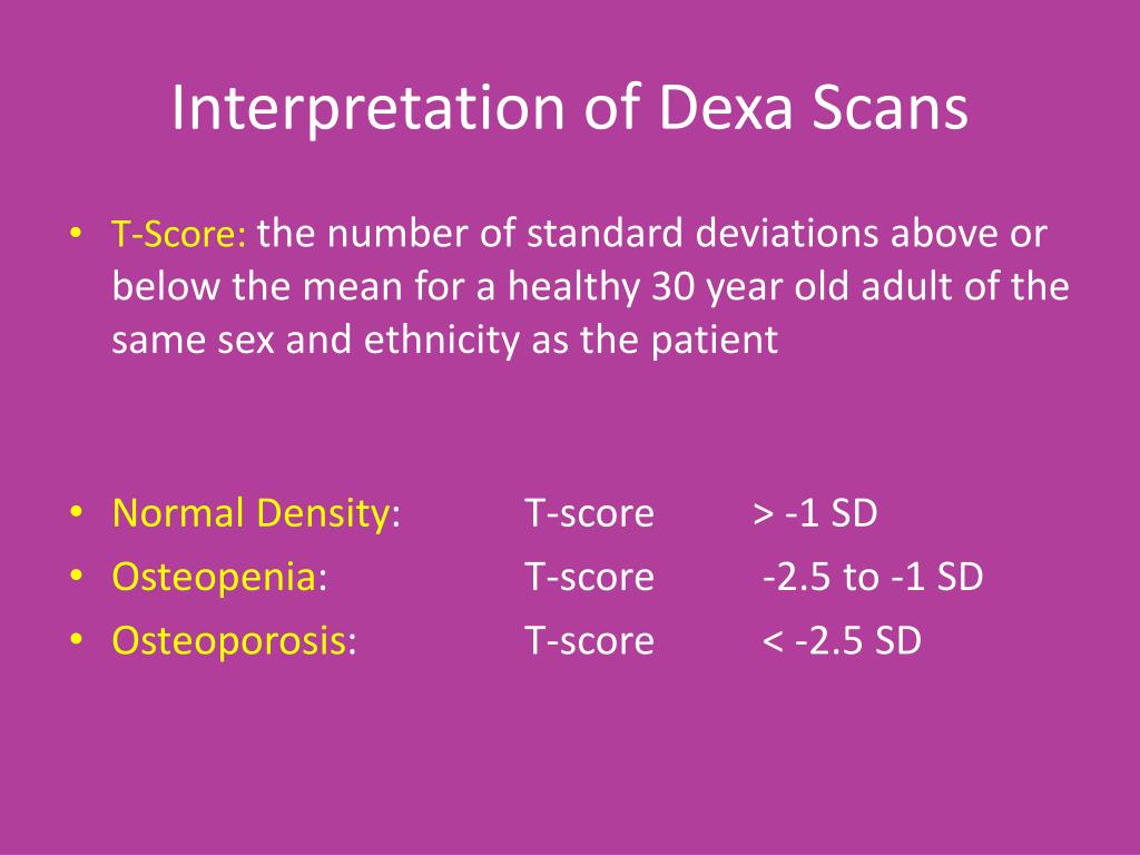 PPT Breast Cancer And Bone Health PowerPoint Presentation Free ppt-breast-cancer-and-bone-health-powerpoint-presentation-free