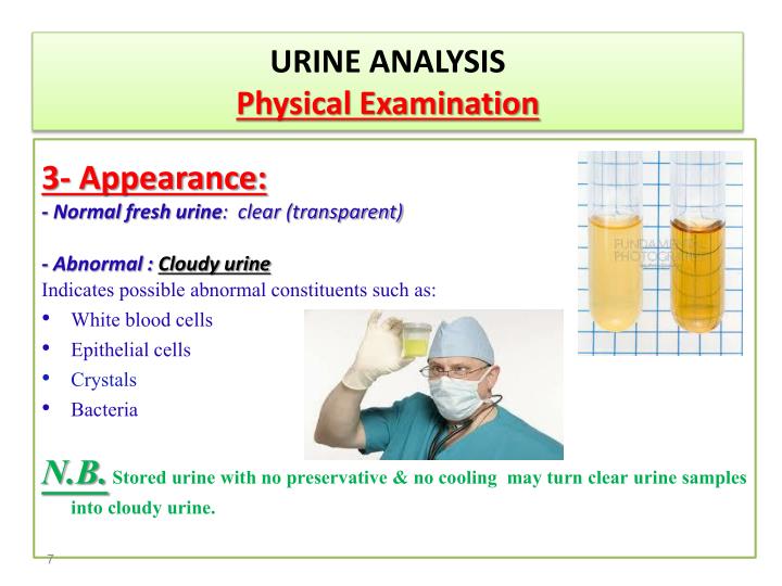 Ppt Urinalysis Powerpoint Presentation Id2773692 5160