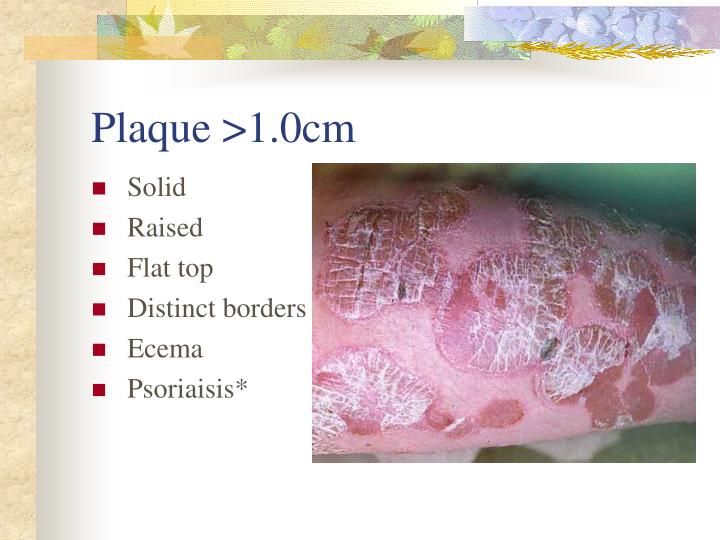 PPT - Rashes and the School Nurse PowerPoint Presentation - ID:2777002