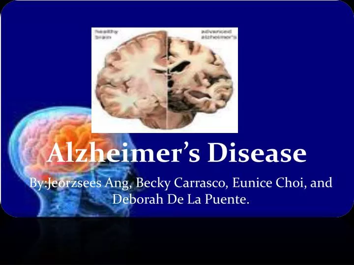 ppt-alzheimer-s-disease-powerpoint-presentation-free-download-id