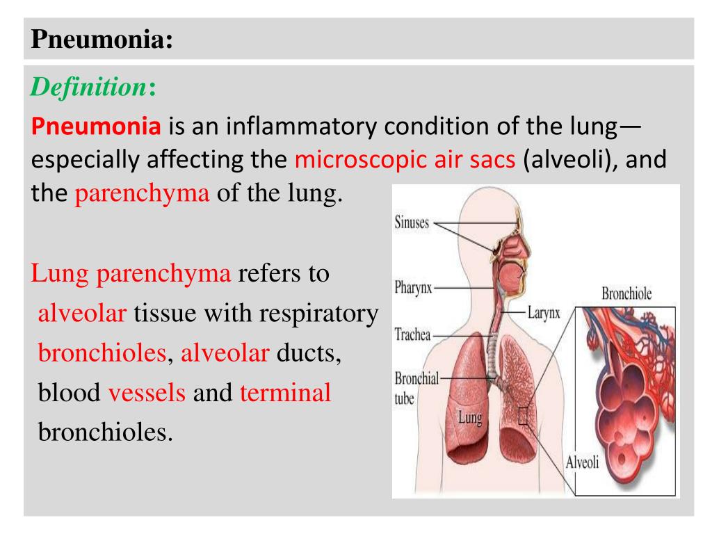 PPT - Pneumonia: PowerPoint Presentation, free download ...