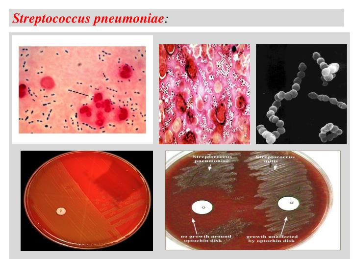 streptococcus pneumoniae essay streptococcus pneumoniae essay