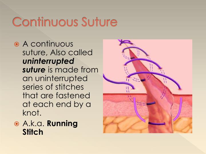 PPT - Suturing PowerPoint Presentation - ID:2789489
