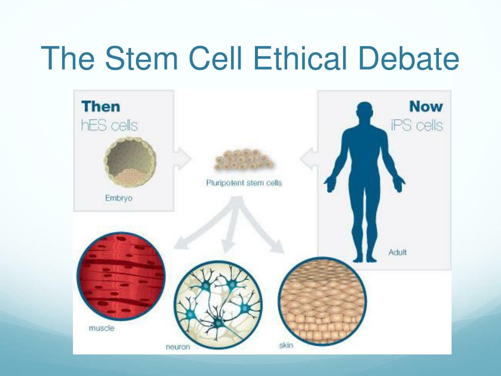 stem cell ethics essay