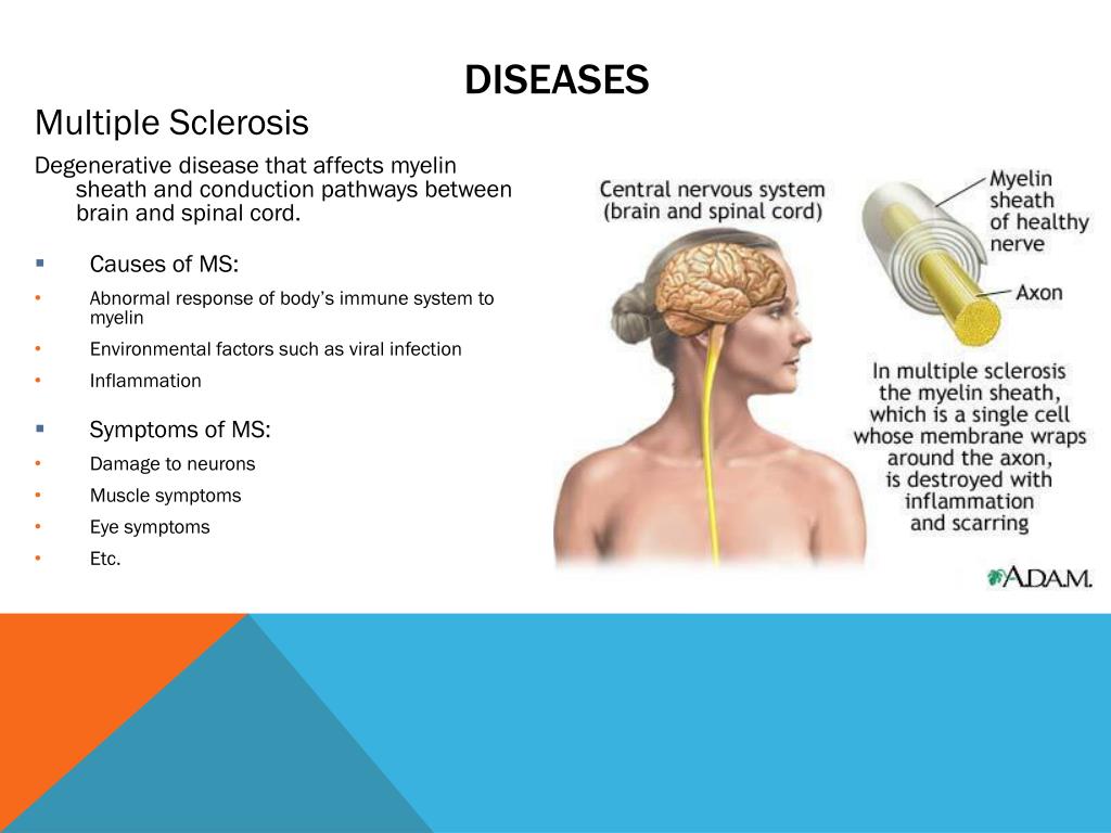 nervous system diseases powerpoint presentation