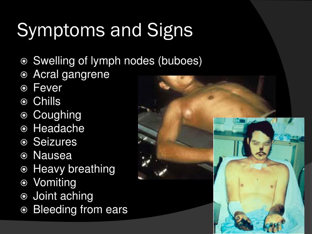 bubonic plague symptoms buboes